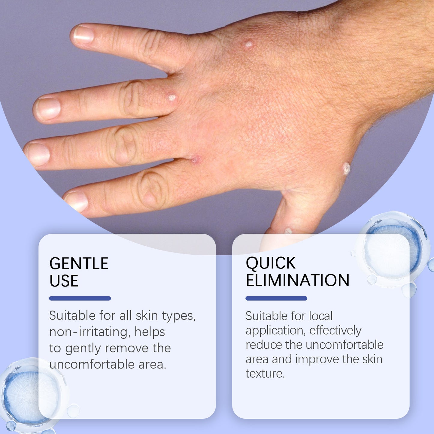 Hands, Feet & Body